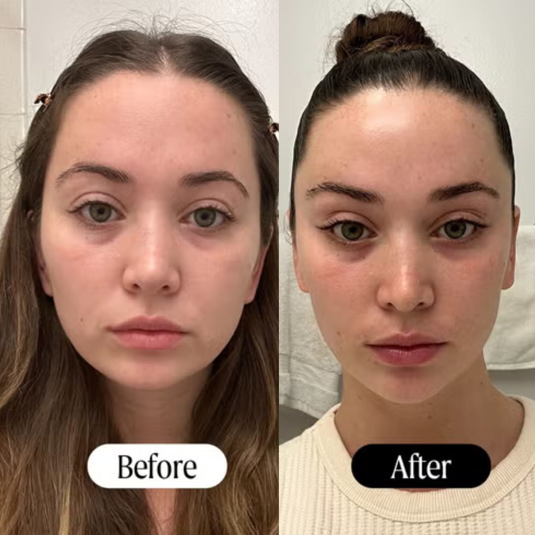 Aluvios™ Facial Sculptor