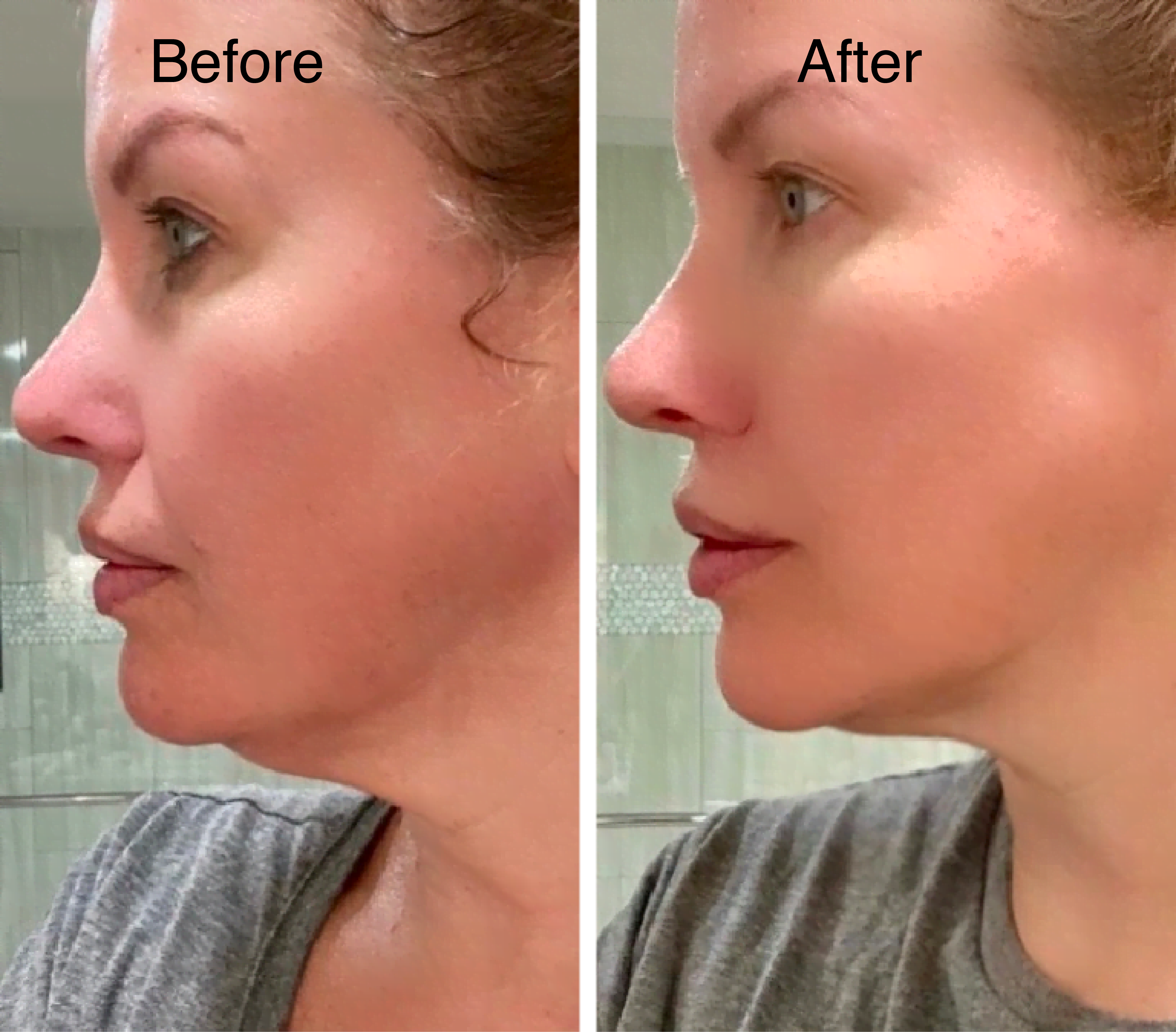 Aluvios™ Facial Sculptor