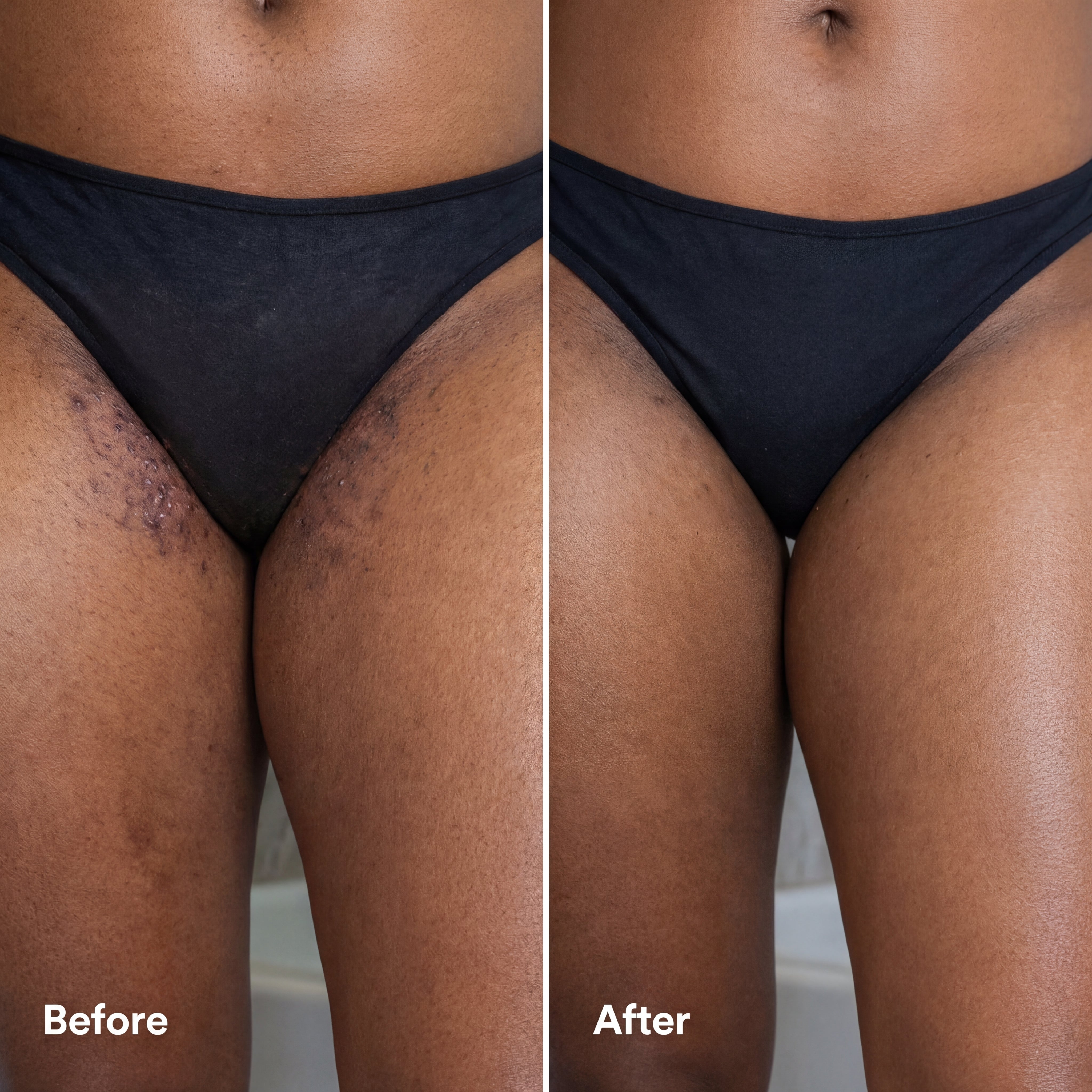 Aluvios™ Exfoliating Serum